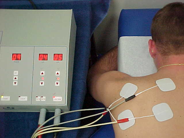 Electrical Stimulation Therapy Alexandria, VA - The Physical Therapy Zone